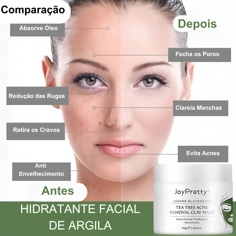 Hidratante Facial que Remove Acnes e Renova a Pele