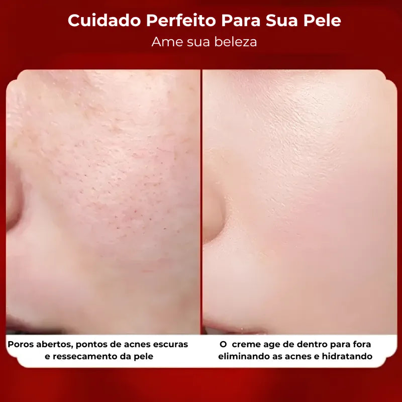 Creme Facial Coreano Sangue de Dragão "Rejuvenesce"