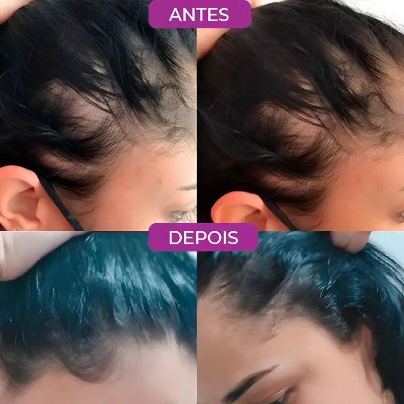 Paralisa a Queda e Acelera o Crescimento Capilar - Growth Hair